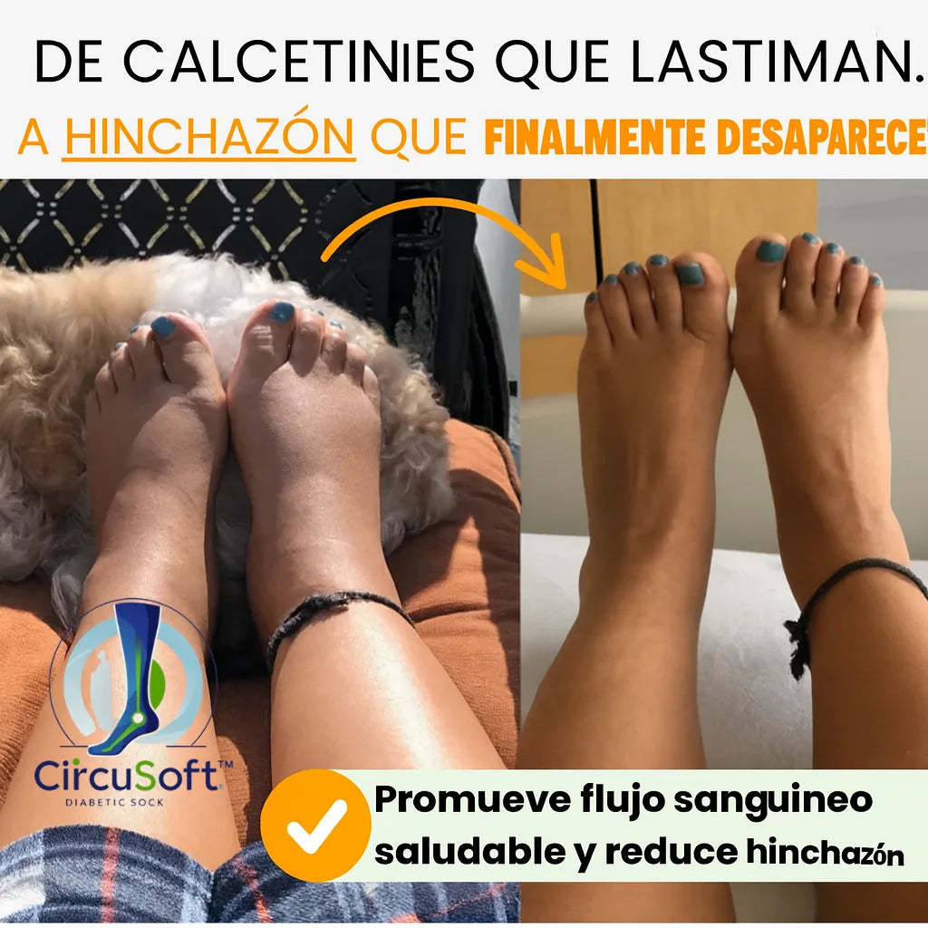 CircuSoft™ – Comodidad sin presión para mantener tu circulación saludable