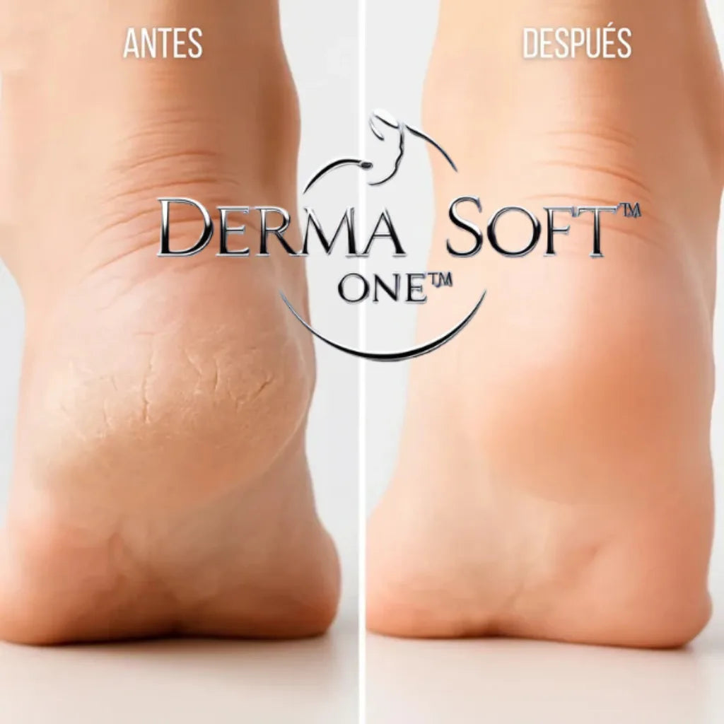 DermaSoft One™ – Elimina durezas y revela pies suaves en minutos