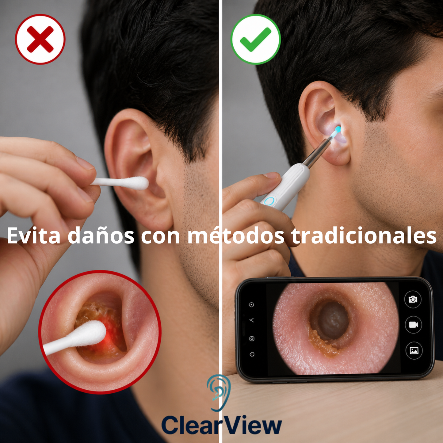 ClearView  - Limpia tus oídos con visión en tiempo real y sin riesgos